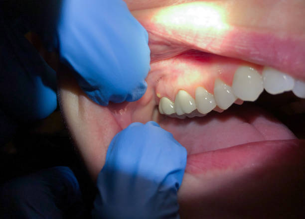 Best Emergency Treatment for Toothache in South Fulton, TN